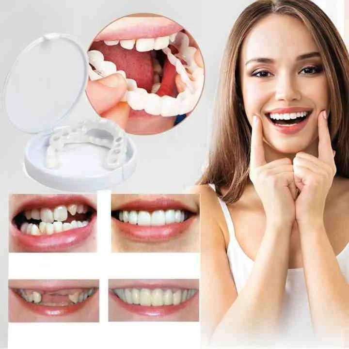 SmileSecure – Klik & Stralend Kunstgebit